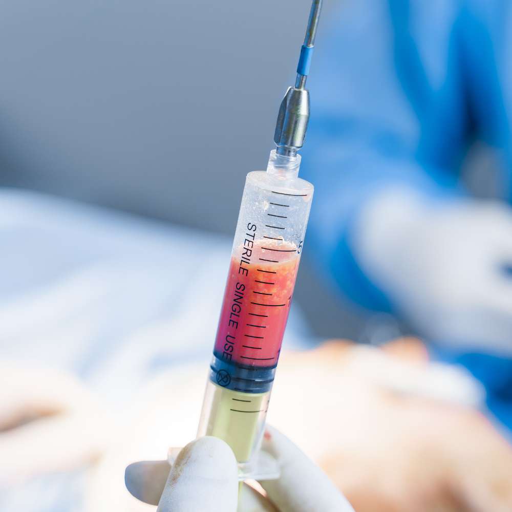 lipotransferencia de grasa autologa