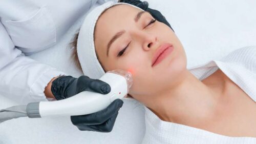 tratamiento laser en madrid